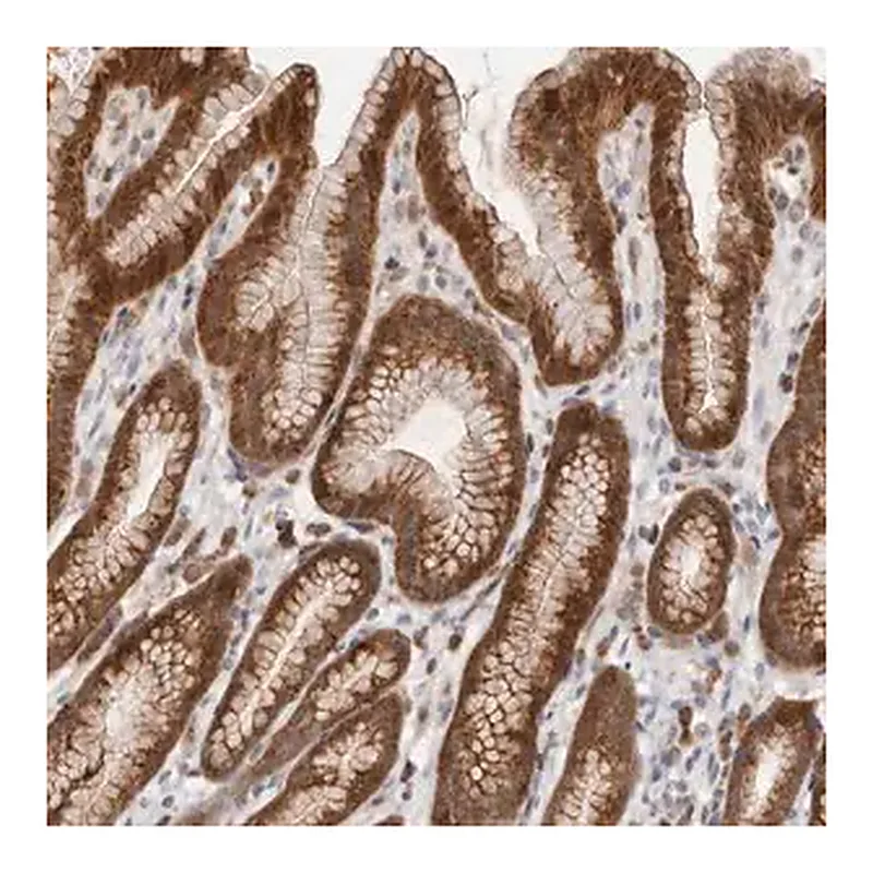 Merck Anti-RNF213 antibody produced in rabbit