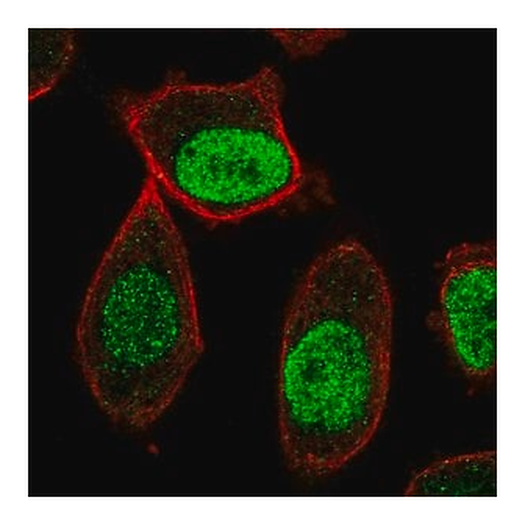 Merck Anti-CENPA antibody produced in rabbit