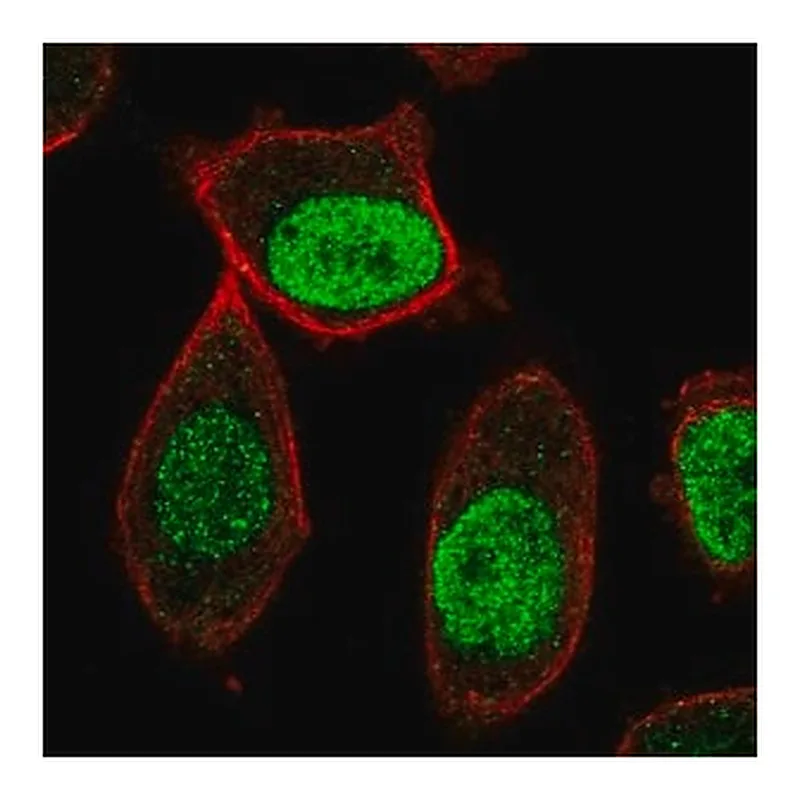 Merck Anti-CENPA antibody produced in rabbit