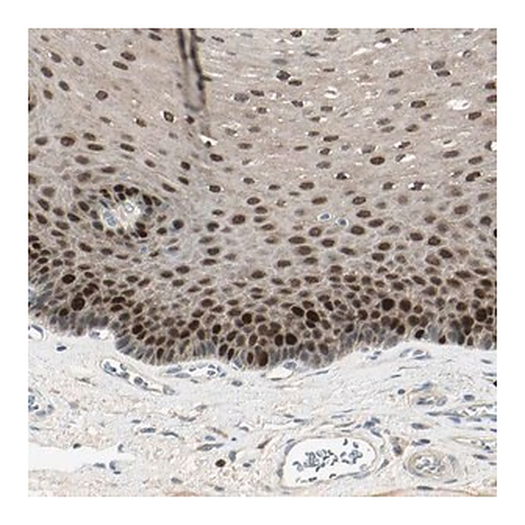 Merck Anti-PITX1 antibody produced in rabbit