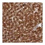 Merck Anti-AGL antibody produced in rabbit