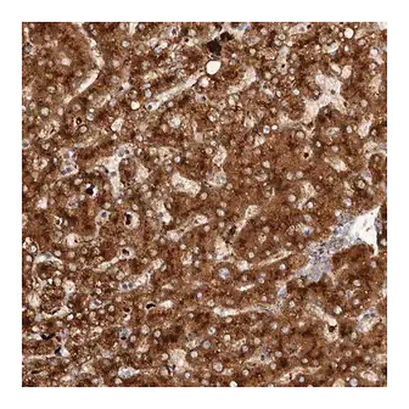 Merck Anti-AGL antibody produced in rabbit