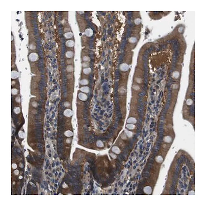 Merck Anti-DENND4C antibody produced in rabbit