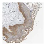 Merck Anti-KRT76 antibody produced in rabbit