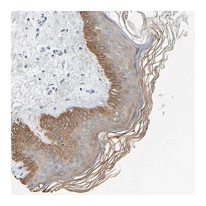 Merck Anti-KRT76 antibody produced in rabbit