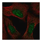 Merck Anti-ATXN3 antibody produced in rabbit