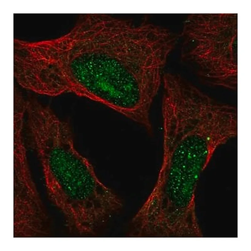 Merck Anti-ATXN3 antibody produced in rabbit