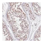 Merck Anti-KLHDC2 antibody produced in rabbit
