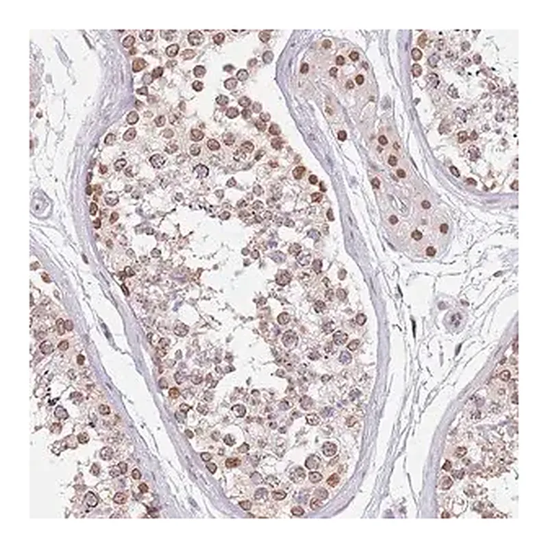 Merck Anti-KLHDC2 antibody produced in rabbit