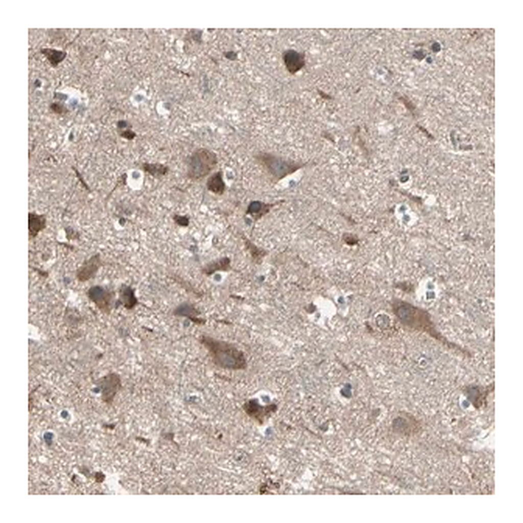 Merck Anti-PNPLA7 antibody produced in rabbit