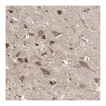 Merck Anti-PNPLA7 antibody produced in rabbit