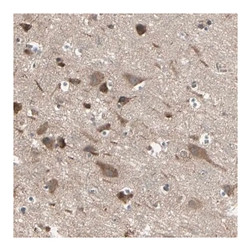 Merck Anti-PNPLA7 antibody produced in rabbit