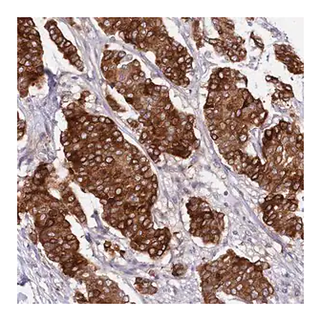 Merck Anti-SLC39A6 antibody produced in rabbit
