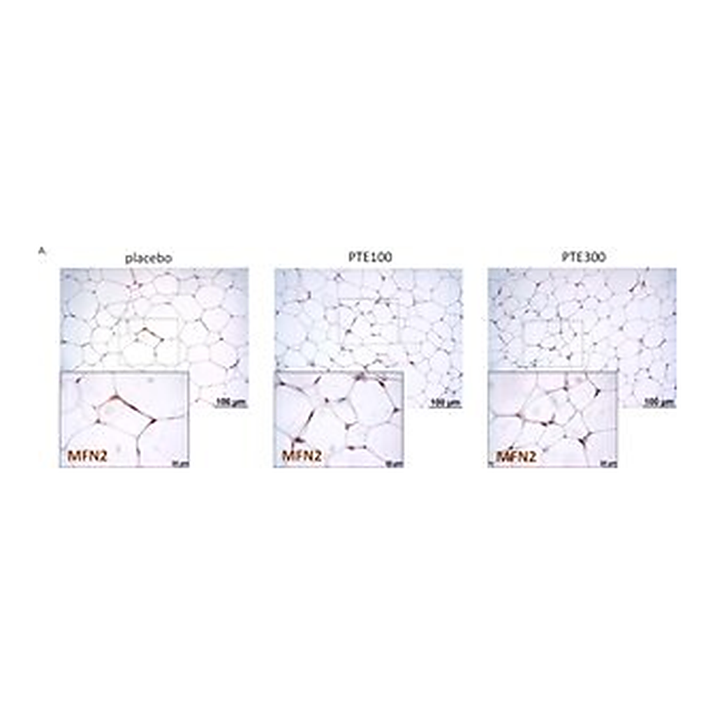 Merck Anti-MFN2 antibody produced in rabbit