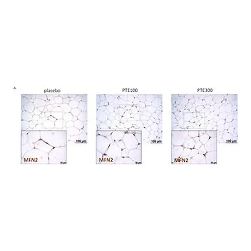 Merck Anti-MFN2 antibody produced in rabbit