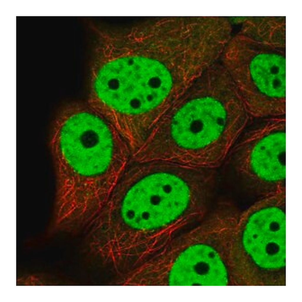 Merck Anti-VHL antibody produced in rabbit
