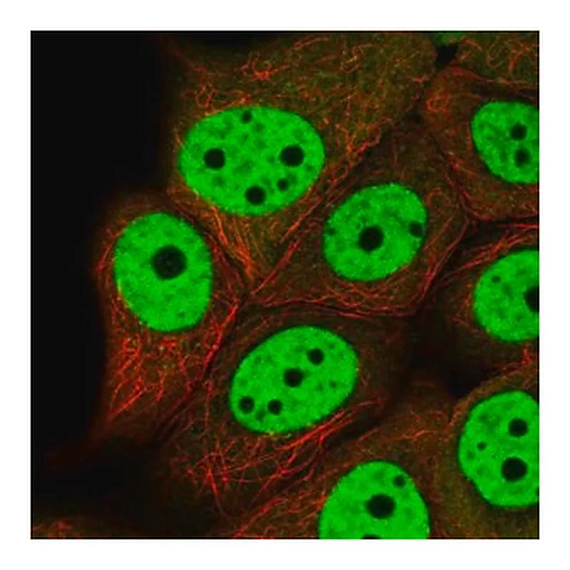Merck Anti-VHL antibody produced in rabbit