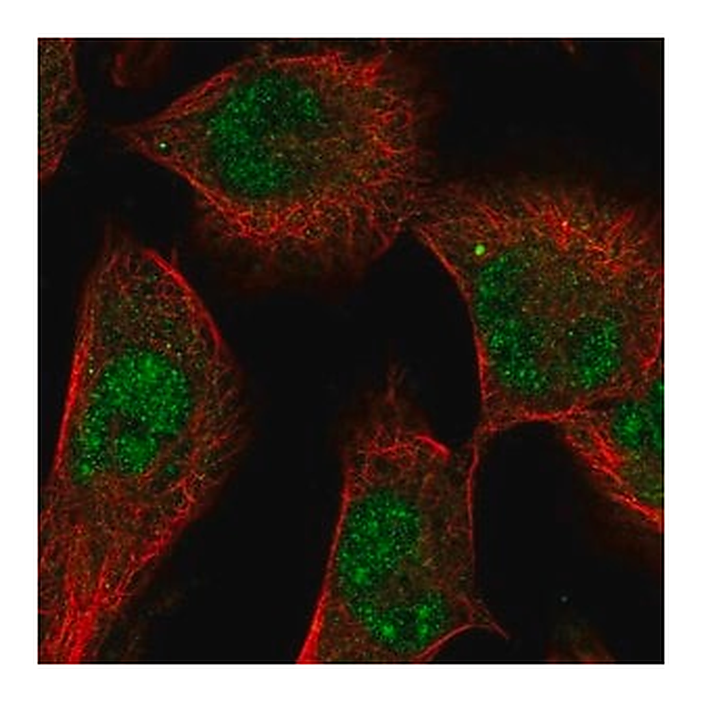 Merck Anti-SGK1 antibody produced in rabbit