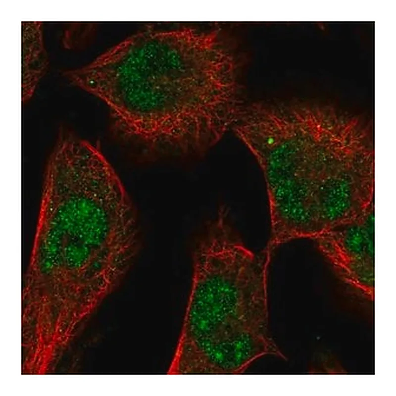Merck Anti-SGK1 antibody produced in rabbit