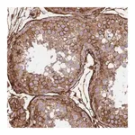 Merck Anti-MAP1LC3B antibody produced in rabbit