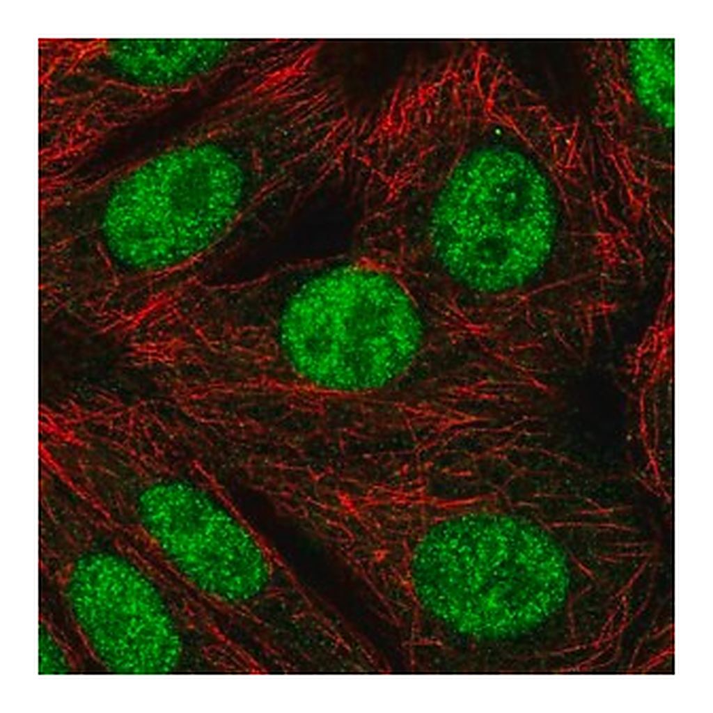 Merck Anti-RNF220 antibody produced in rabbit