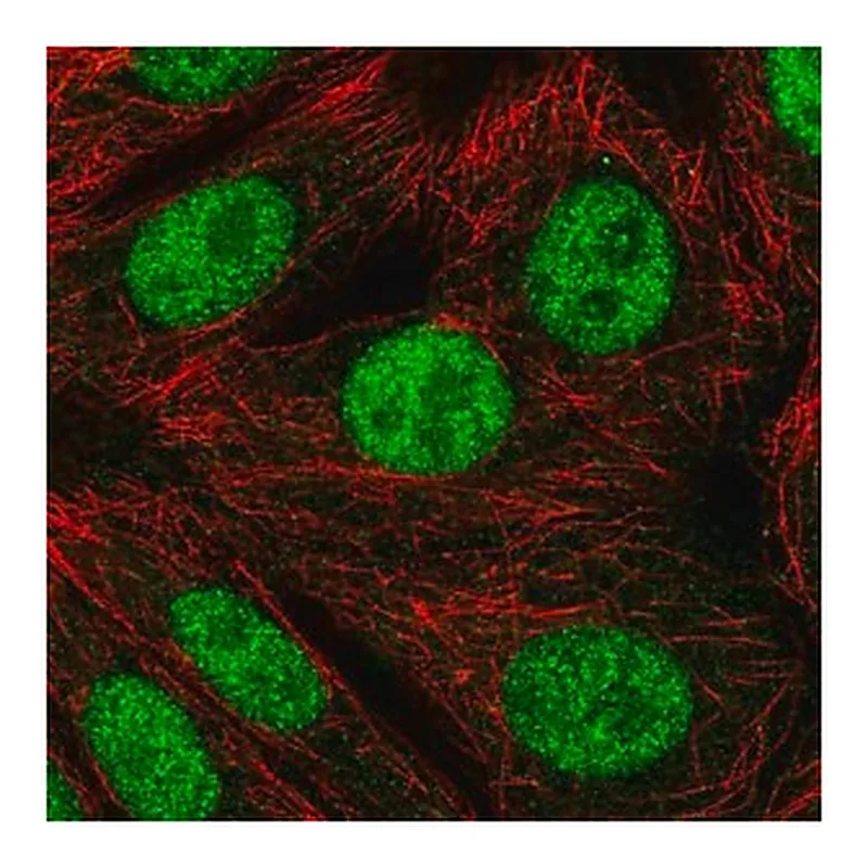 Merck Anti-RNF220 antibody produced in rabbit