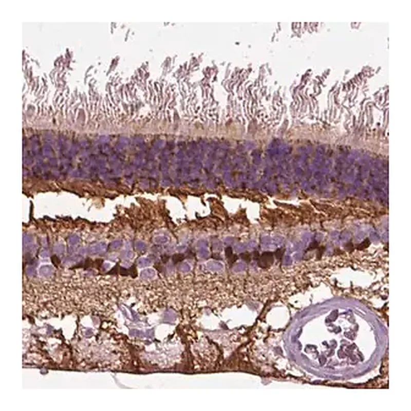 Merck Anti-CRABP1 antibody produced in rabbit