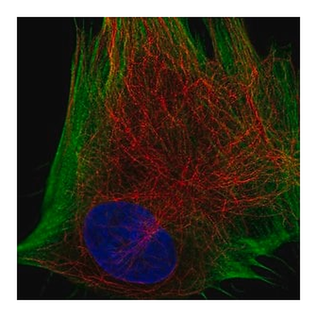 Merck Anti-DDR2 antibody produced in rabbit