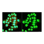 Merck Anti-SNF2β/BRG1 Antibody