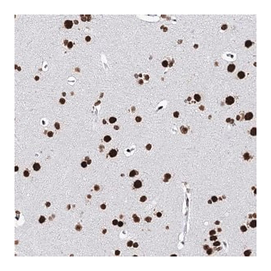 Merck Anti-MATR3 antibody produced in rabbit
