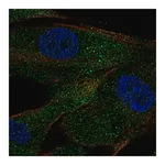 Merck Anti-ACE antibody produced in rabbit