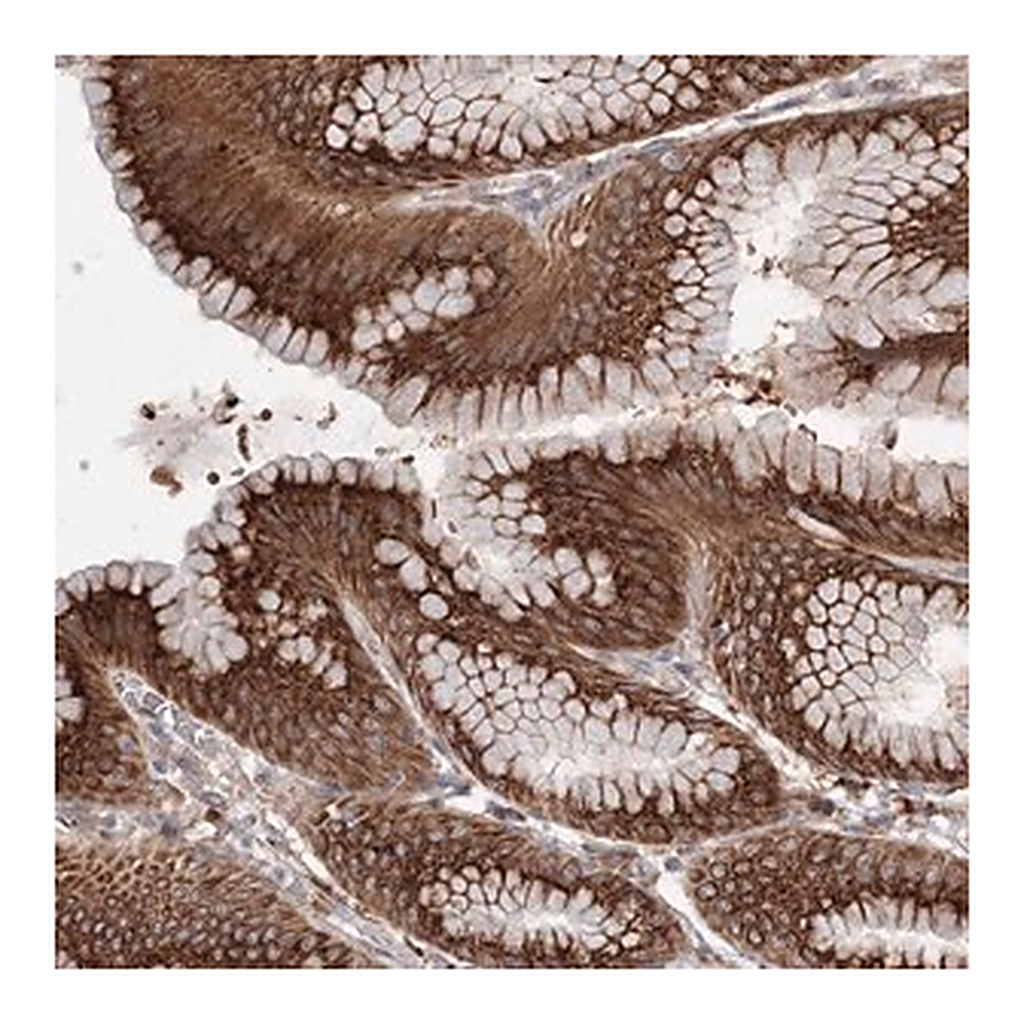 Merck Anti-DIS3L2 antibody produced in rabbit