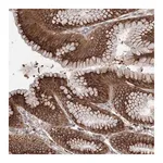 Merck Anti-DIS3L2 antibody produced in rabbit