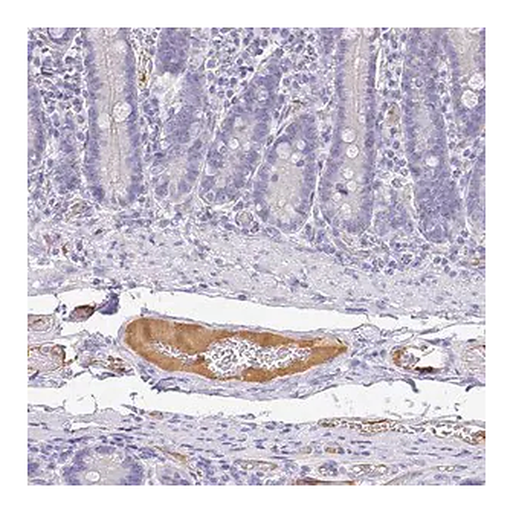 Merck Anti-APOB antibody produced in rabbit
