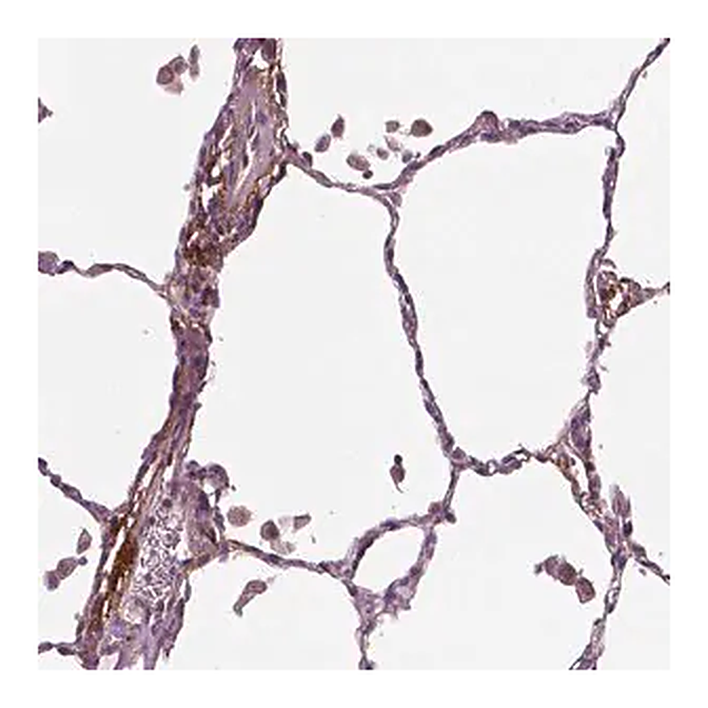 Merck Anti-PTX3 antibody produced in rabbit