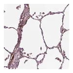 Merck Anti-PTX3 antibody produced in rabbit