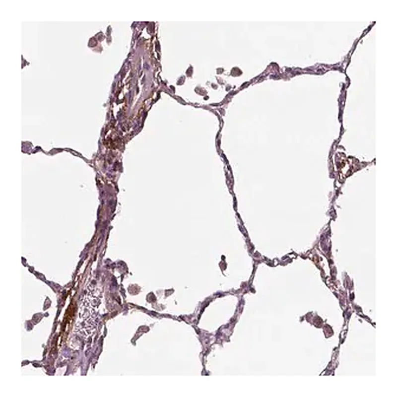 Merck Anti-PTX3 antibody produced in rabbit