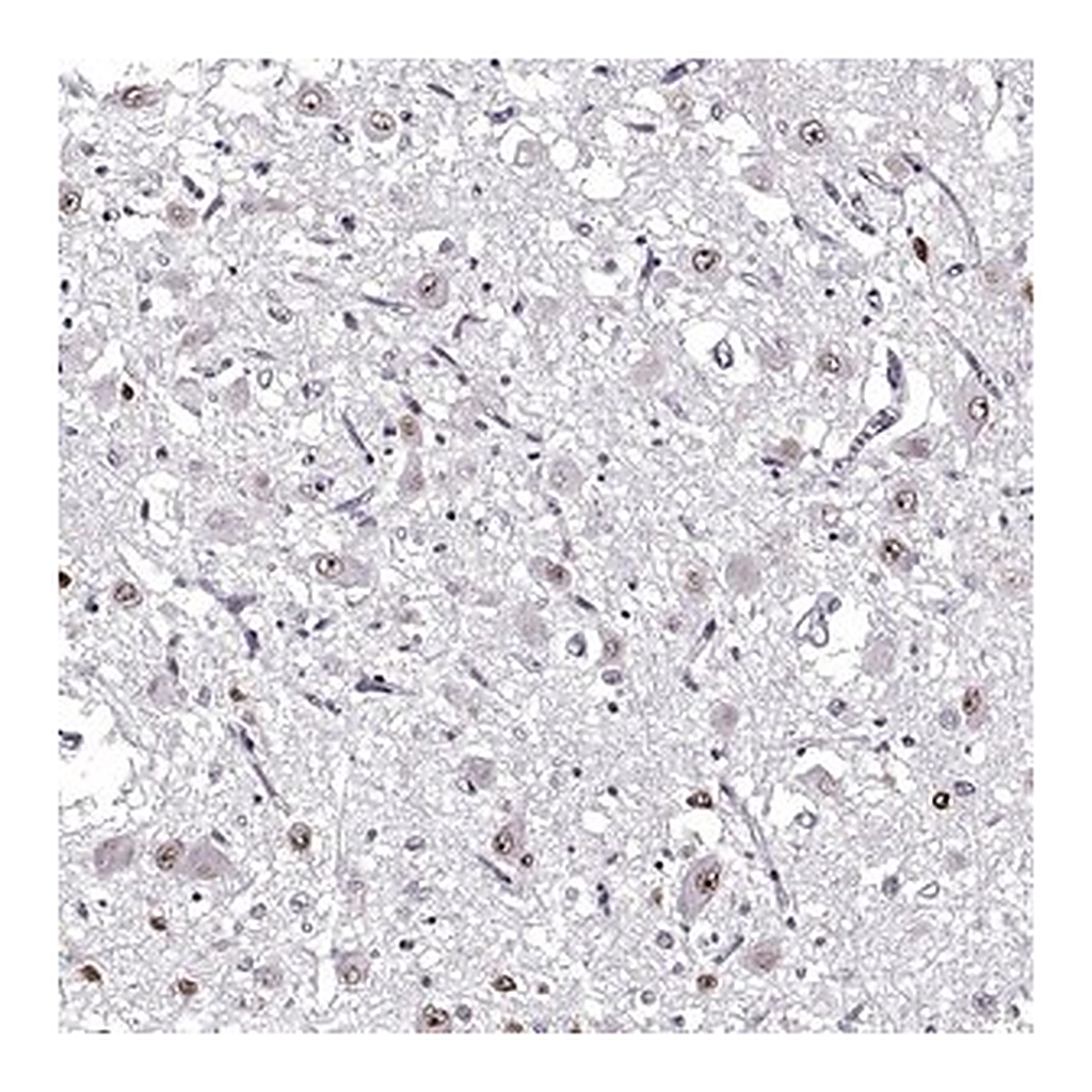 Merck Anti-OTP antibody produced in rabbit
