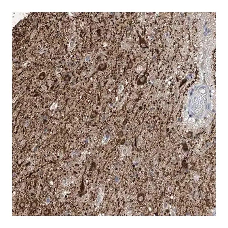 Merck Anti-ZNF189 antibody produced in rabbit