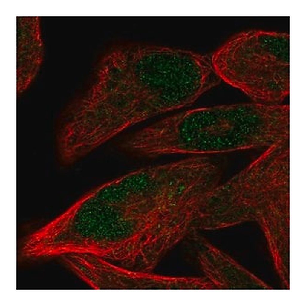 Merck Anti-PRDM12 antibody produced in rabbit