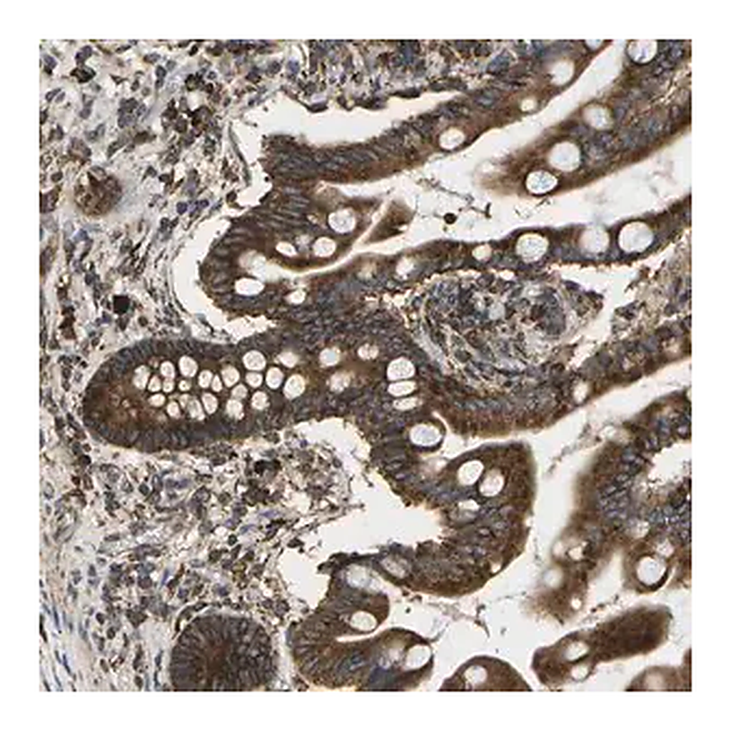 Merck Anti-SLC39A14 antibody produced in rabbit