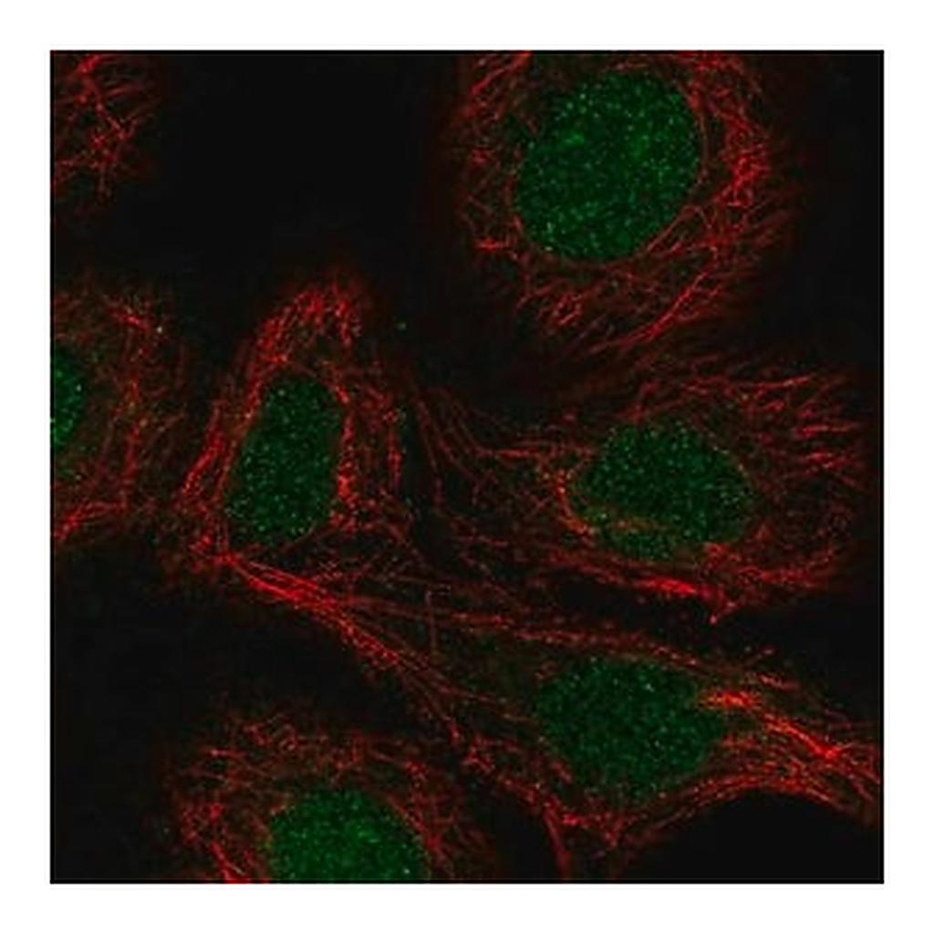 Merck Anti-RARA antibody produced in rabbit