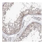 Merck Anti-PHF20L1 antibody produced in rabbit