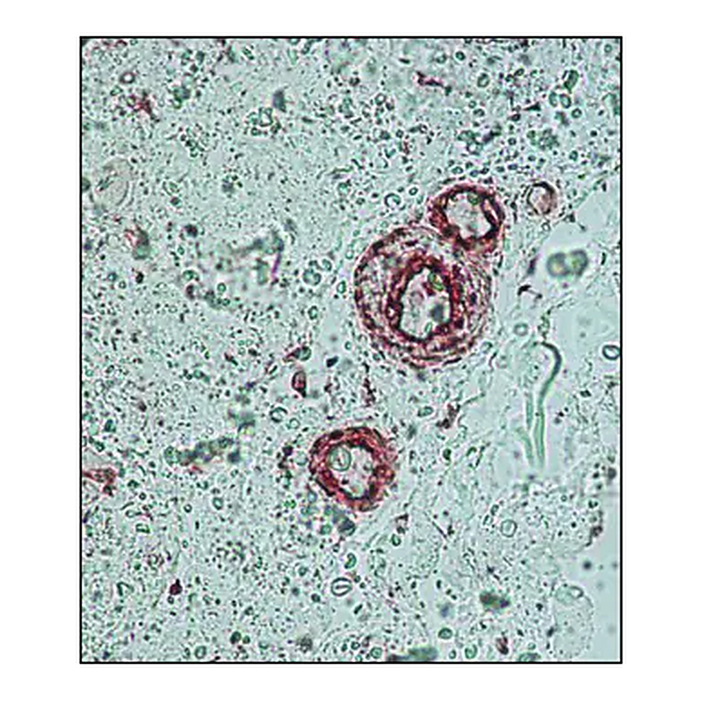 Merck Anti-γ-Actin antibody, Mouse monoclonal