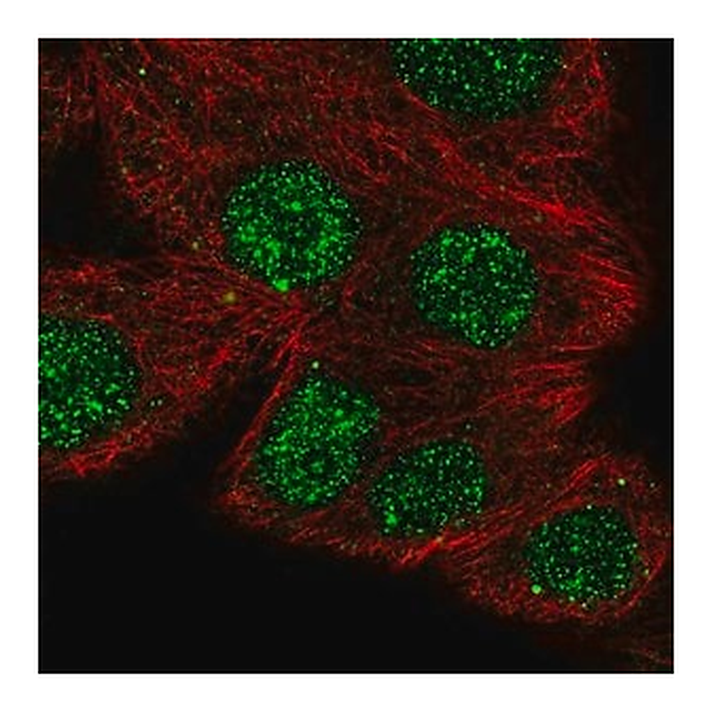 Merck Anti-NFATC1 antibody produced in rabbit