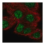 Merck Anti-NFATC1 antibody produced in rabbit