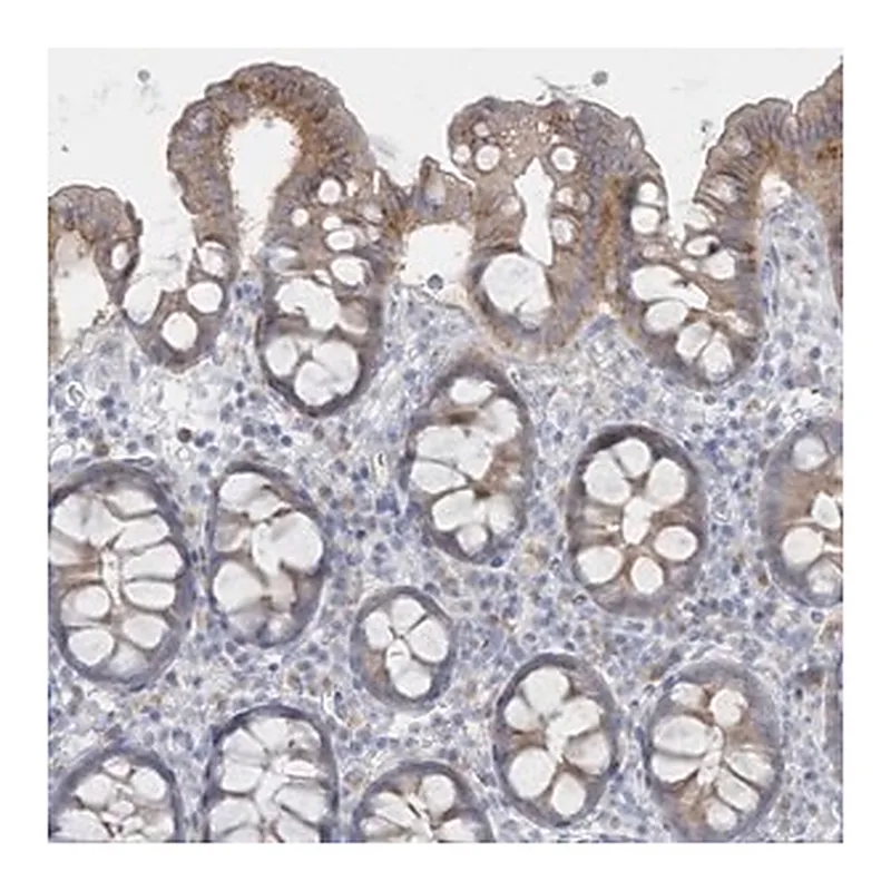 Merck Anti-SEMA3D antibody produced in rabbit