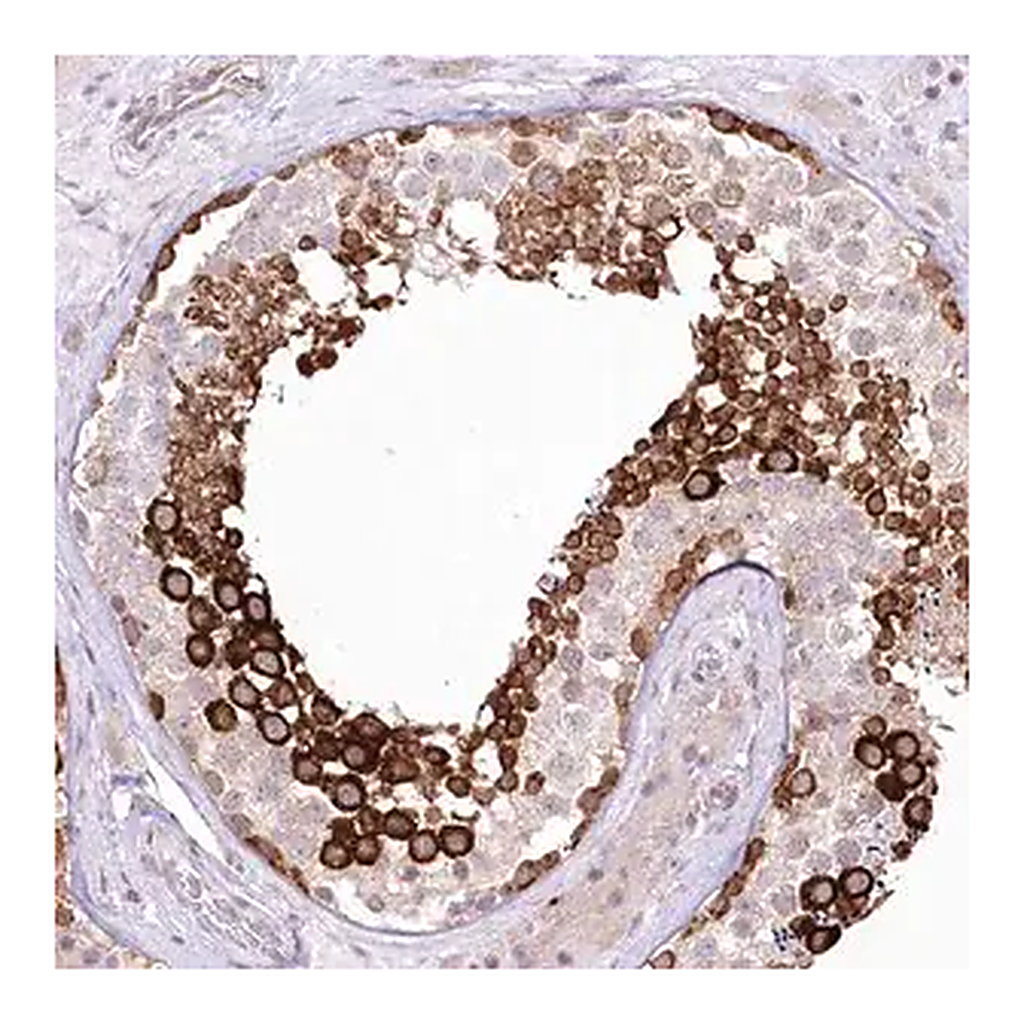 Merck Anti-YBX3 antibody produced in rabbit