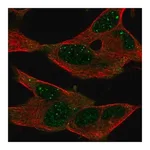 Merck Anti-GPR155 antibody produced in rabbit