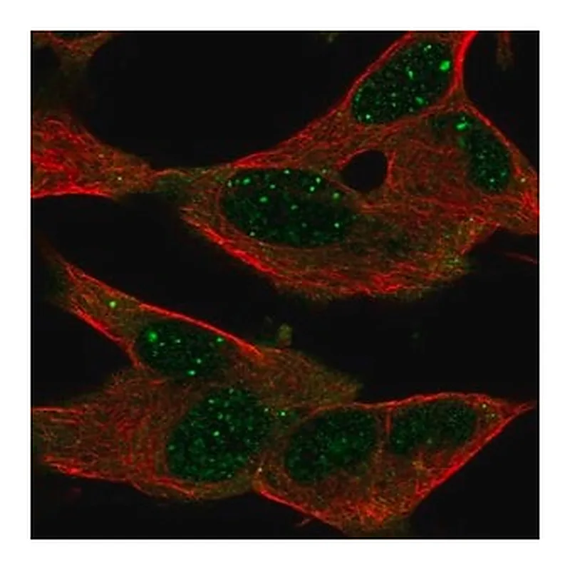 Merck Anti-GPR155 antibody produced in rabbit